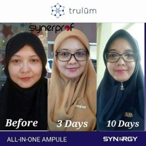 testimoni pemakaian trulum