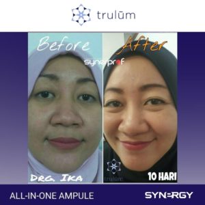 testimoni pemakaian trulum
