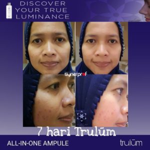 testimoni pemakaian trulum