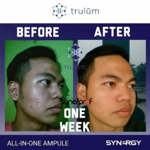 testimoni pemakaian trulum