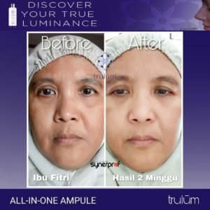 testimoni pemakaian trulum