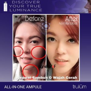 testimoni pemakaian trulum