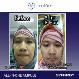 testimoni pemakaian trulum